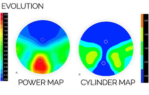 Novar Lens Design | Evolution Map | Coburn Technologies